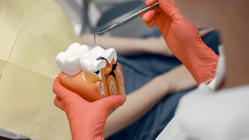 Model of a tooth at the dentist.Doctor shows the patient a tooth.Reception in the dentist's office
